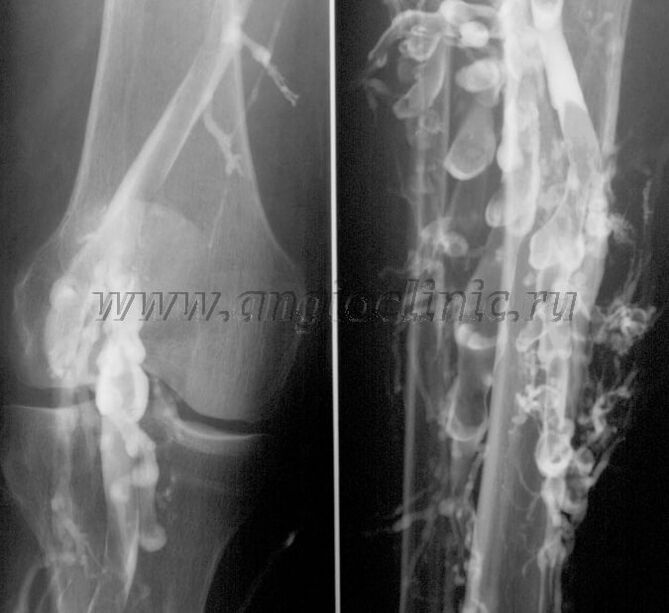 Scansione ad ultrasuoni